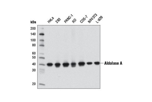 Western Blotting Image 1: Aldolase A (D73H4) Rabbit mAb