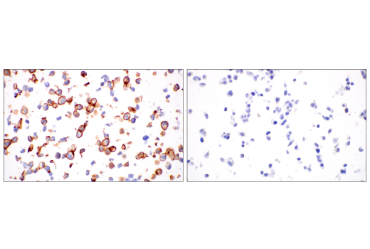 Immunohistochemistry Image 1: ACE2 (OTI1G4) Mouse Monoclonal Antibody