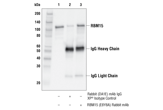 Immunoprecipitation Image 1: RBM15 (E8Y8A) Rabbit Monoclonal Antibody