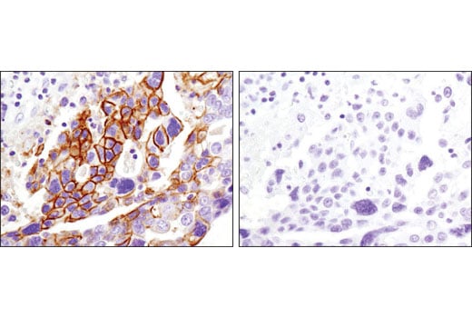 Immunohistochemistry Image 3: CD82 (D7G6H) Rabbit Monoclonal Antibody