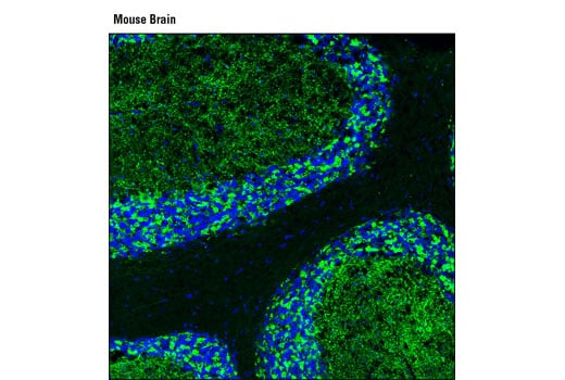 Immunofluorescence Image 1: GAD2 (D5G2) Rabbit Monoclonal Antibody