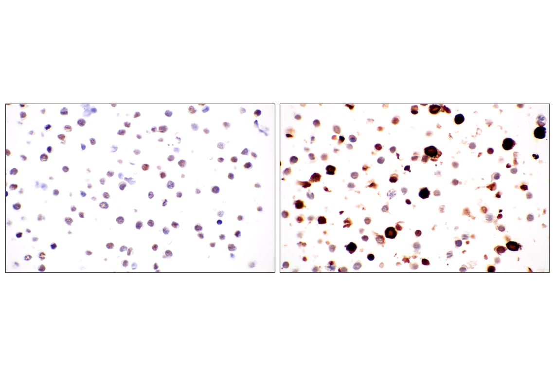 FOXG1 (E2W8P) Rabbit mAb | Cell Signaling Technology