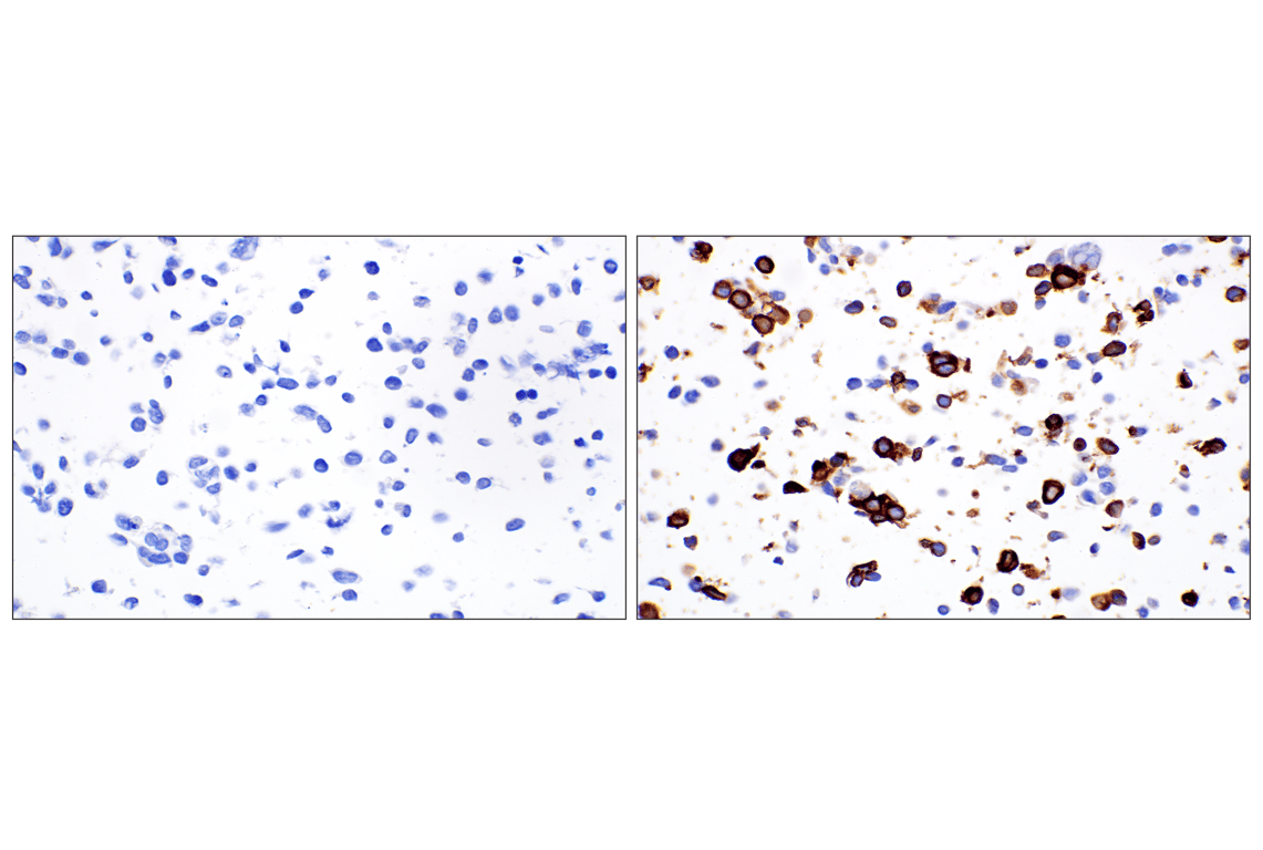 Immunohistochemistry Image 9: NCR1/NKp46 (F8M2L) Rabbit Monoclonal Antibody (IHC Formulated)