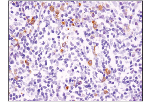 Immunohistochemistry Image 3: BLNK (D3P2H) Rabbit Monoclonal Antibody (BSA and Azide Free)