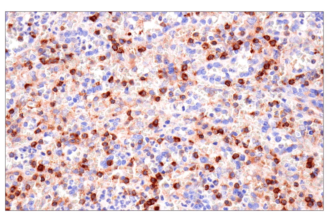 Immunohistochemistry Image 7: SPAK (F7T1K) Rabbit Monoclonal Antibody