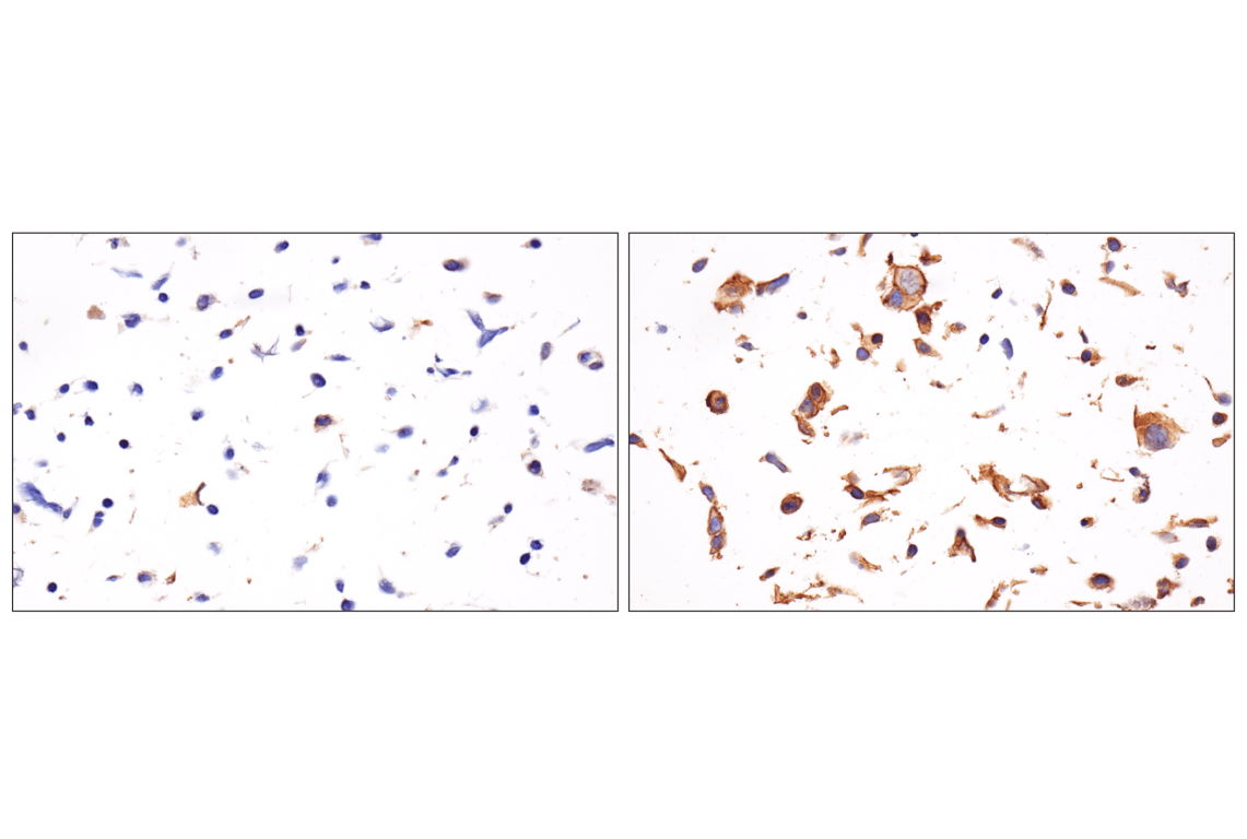 Immunohistochemistry Image 7: PD-L1 (F3Z1T) Rabbit Monoclonal Antibody (IHC Formulated)