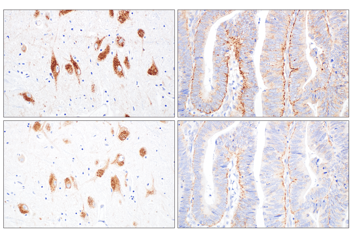Immunohistochemistry Image 10: Presenilin 2 (F7E5Q) Rabbit Monoclonal Antibody