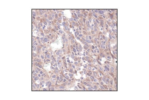undefined Image 19: 4E-BP Antibody Sampler Kit