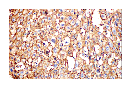 Immunohistochemistry Image 1: Glut1 (E4S6I) Rabbit Monoclonal Antibody
