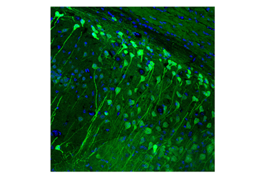 Immunofluorescence Image 1: UCHL1 (D3T2E) Rabbit Monoclonal Antibody (BSA and Azide Free)