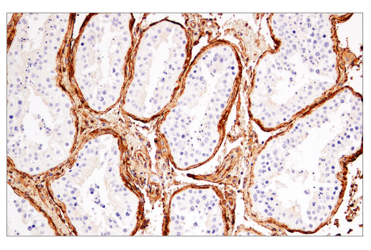 Immunohistochemistry Image 4: CD141/Thrombomodulin (E7Y9P) Rabbit Monoclonal Antibody (BSA and Azide Free)