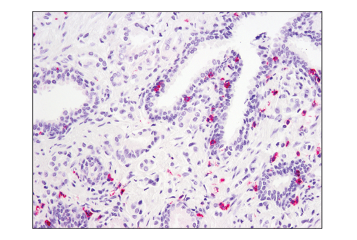 Immunohistochemistry Image 2: SignalStain<sup>®</sup> Boost IHC Detection Reagent (AP, Mouse)