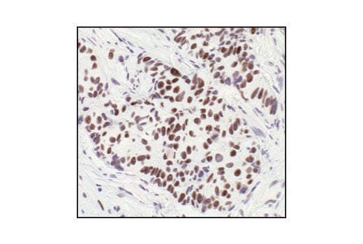 undefined Image 27: HSP/Chaperone Antibody Sampler Kit