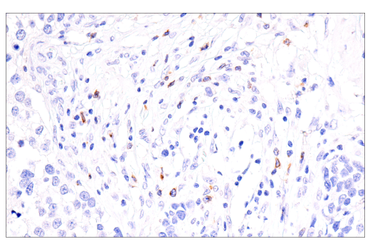 Immunohistochemistry Image 4: CTLA-4 (E2V1Z) Rabbit Monoclonal Antibody (BSA and Azide Free)