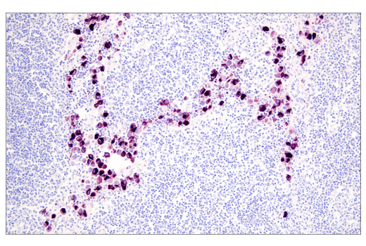 Immunohistochemistry Image 1: PMEL/Melanoma gp100 (HMB45) Mouse Monoclonal Antibody