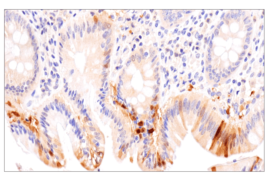 Immunohistochemistry Image 5: APOBEC3A (UMN-13) Rabbit Monoclonal Antibody