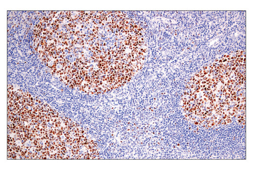 Immunohistochemistry Image 2: BCL6 (E5I8I) Rabbit Monoclonal Antibody (BSA and Azide Free)