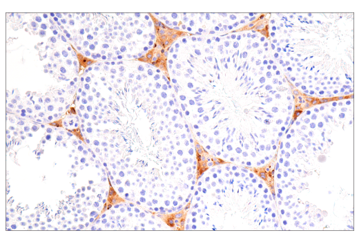Immunohistochemistry Image 4: ApoE (E7X2A) Rabbit Monoclonal Antibody