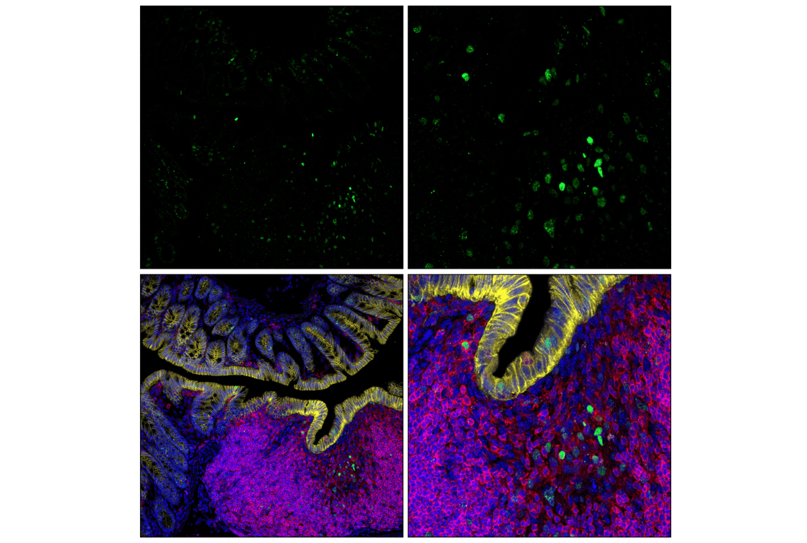 Immunofluorescence Image 1: Phospho-Histone H2A.X (Ser139) (20E3) Rabbit Monoclonal Antibody