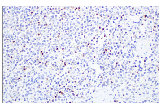 undefined Image 89: Human Exhausted CD8<sup>+</sup> T Cell IHC Antibody Sampler Kit