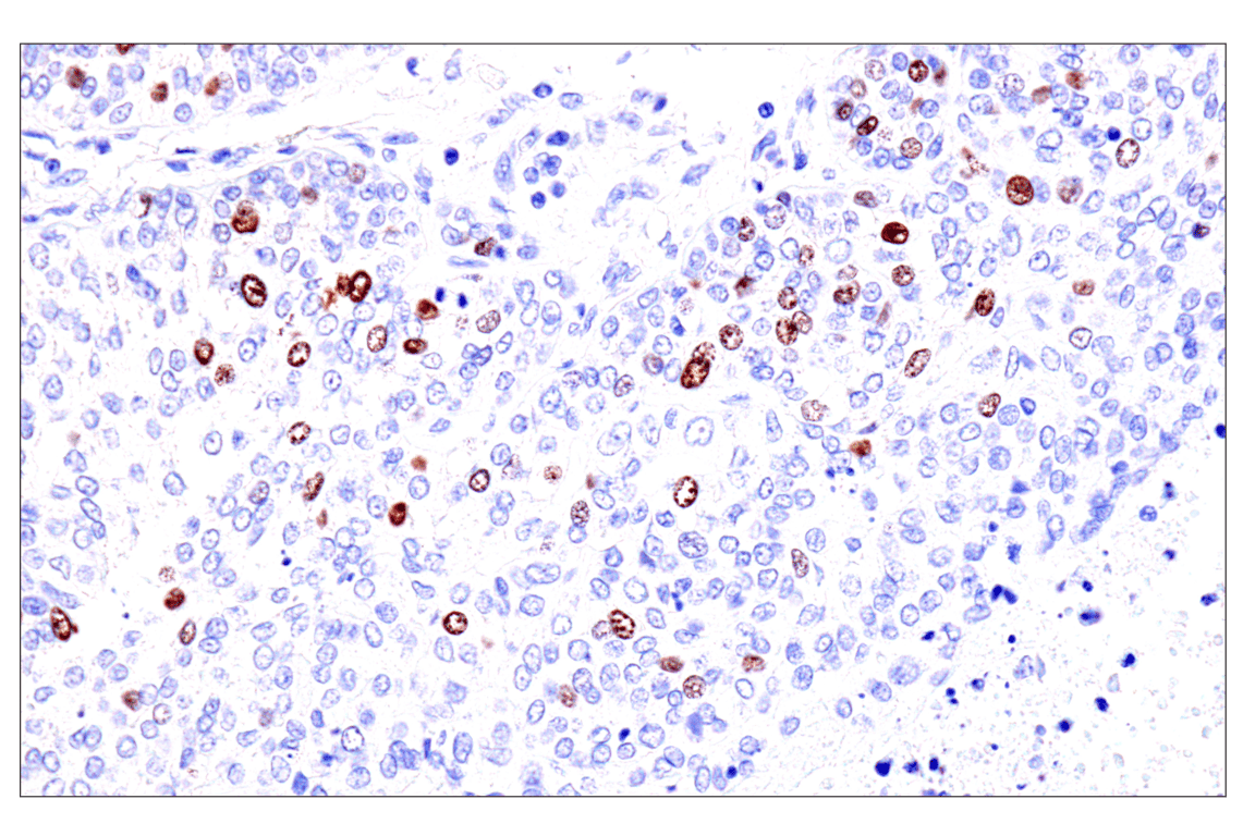 Immunohistochemistry Image 5: Phospho-NPM1 (Thr199) (E4C7S) Rabbit Monoclonal Antibody (BSA and Azide Free)