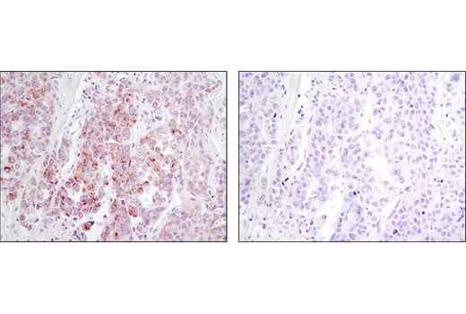 Immunohistochemistry Image 2: DDR1 (D1G6) Rabbit Monoclonal Antibody (BSA and Azide Free)