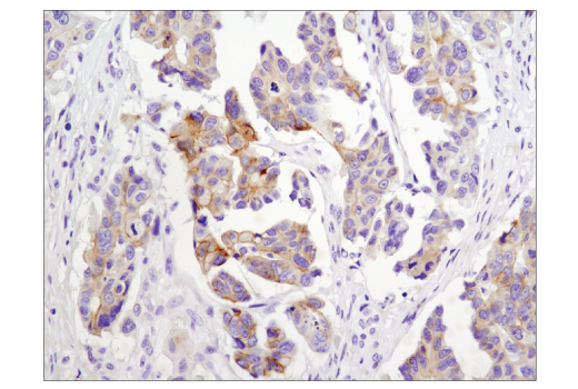 Immunohistochemistry Image 1: N-Cadherin (D4R1H) Rabbit Monoclonal Antibody (BSA and Azide Free)