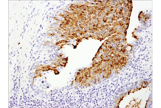 Immunohistochemistry Image 5: OLFM4 (D1E4M) Rabbit Monoclonal Antibody