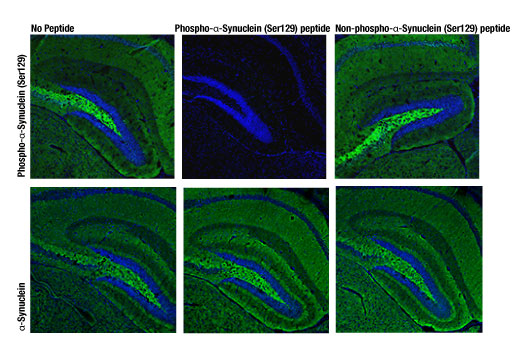 Immunofluorescence Image 1: Phospho-alpha-Synuclein (Ser129) (D1R1R) Rabbit Monoclonal Antibody (BSA and Azide Free)