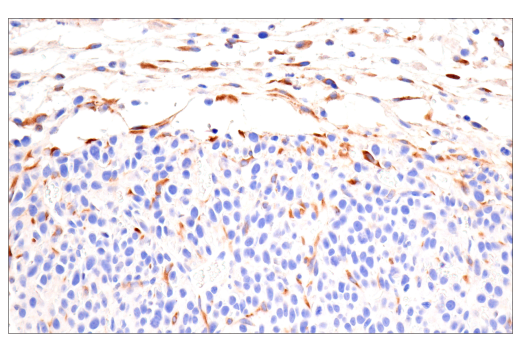 Immunohistochemistry Image 8: CTHRC1 (E8M9S) Rabbit Monoclonal Antibody