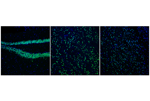 Immunofluorescence Image 2: Bcl-11B (D6F1) Rabbit Monoclonal Antibody (BSA and Azide Free)