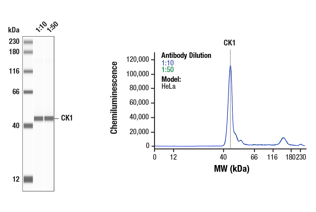 Western Blotting Image 1: CK1 Antibody