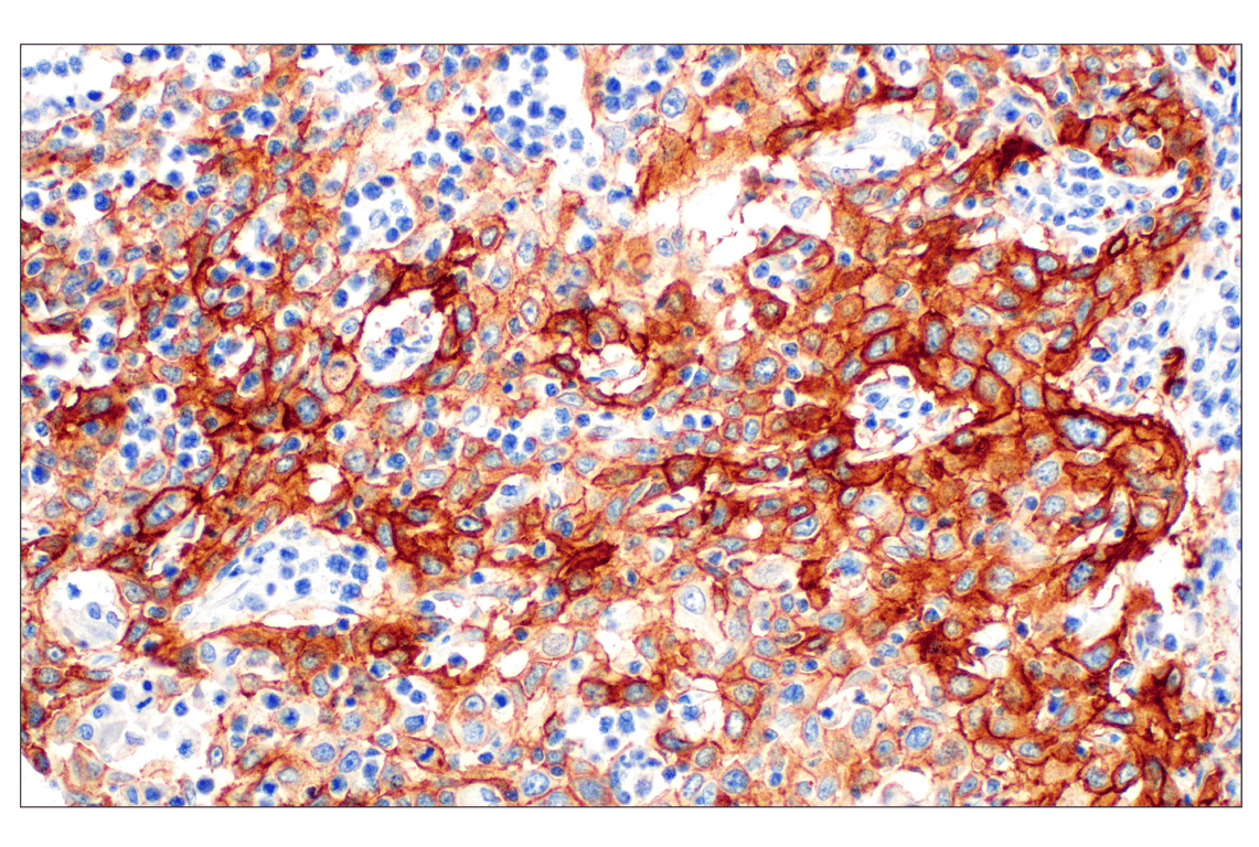 Immunohistochemistry Image 3: Integrin beta6 (E4M9P) Rabbit Monoclonal Antibody (BSA and Azide Free)