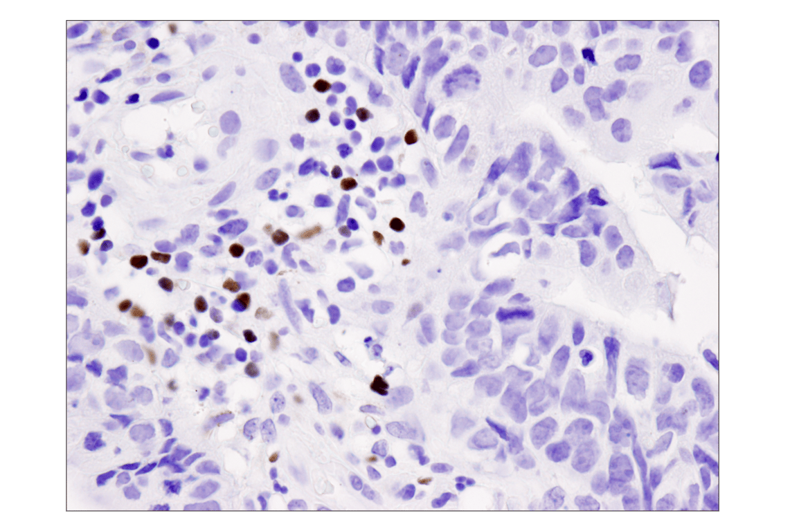 Immunohistochemistry Image 1: FoxP3 (D2W8E<sup>™</sup>) Rabbit mAb
