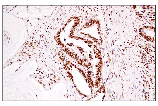 Immunohistochemistry Image 6: DEK (E4S5J) Rabbit Monoclonal Antibody