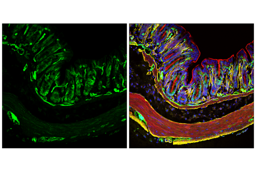 Immunofluorescence Image 1: Phospho-NDRG1 (Thr346) (D98G11) Rabbit Monoclonal Antibody