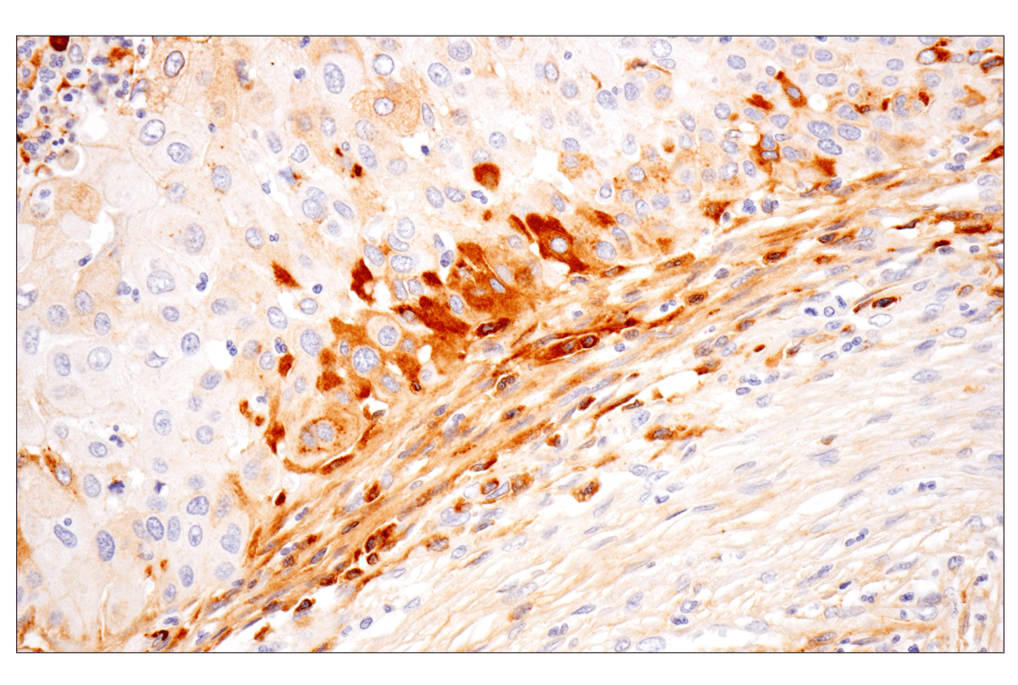 Immunohistochemistry Image 3: MMP-1 (E9S9N) Rabbit Monoclonal Antibody