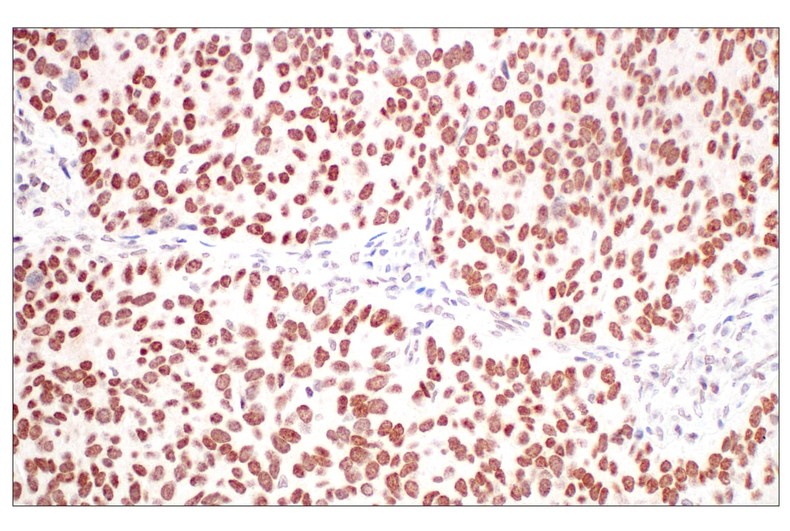 Immunohistochemistry Image 1: Menin (E5P1R) Rabbit Monoclonal Antibody