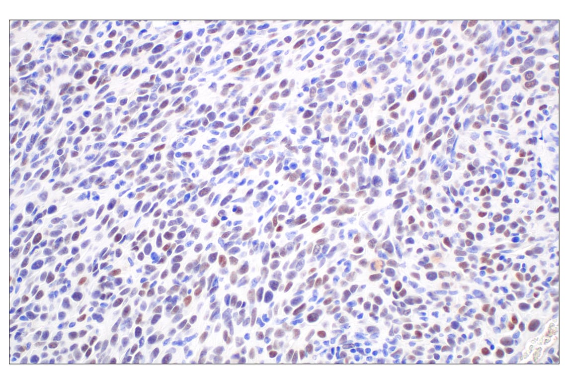 Immunohistochemistry Image 4: FOXG1 (E2W8P) Rabbit Monoclonal Antibody