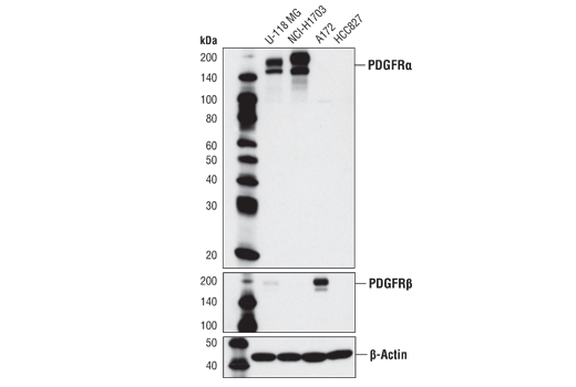 Western Blotting Image 1: PDGF Receptor α (D13C6) XP<sup>®</sup> Rabbit mAb