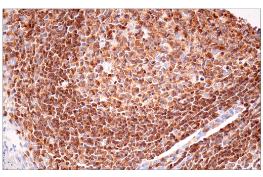Immunohistochemistry Image 7: SLAMF6/CD352 (E3H1E) Rabbit Monoclonal Antibody