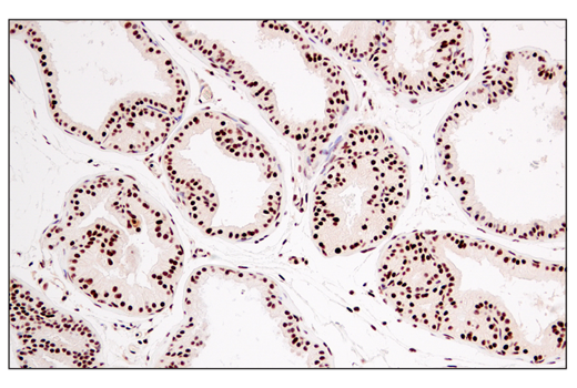 Immunohistochemistry Image 4: DEK (E4S5J) Rabbit Monoclonal Antibody