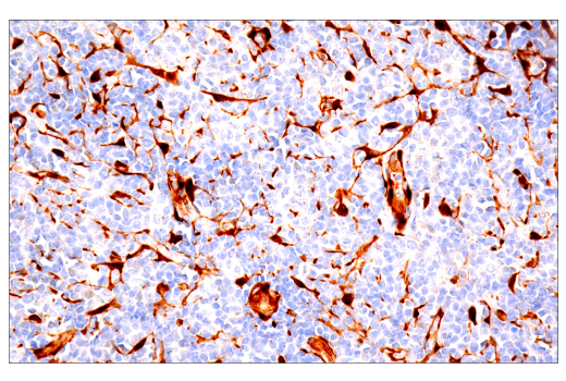 Immunohistochemistry Image 3: YAP/TAZ (E9M8G) Rabbit Monoclonal Antibody (BSA and Azide Free)