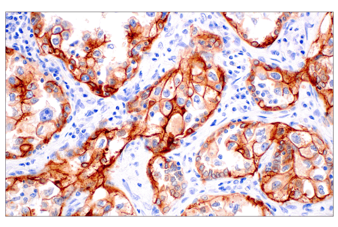 Immunohistochemistry Image 1: Integrin beta6 (E4M9P) Rabbit Monoclonal Antibody