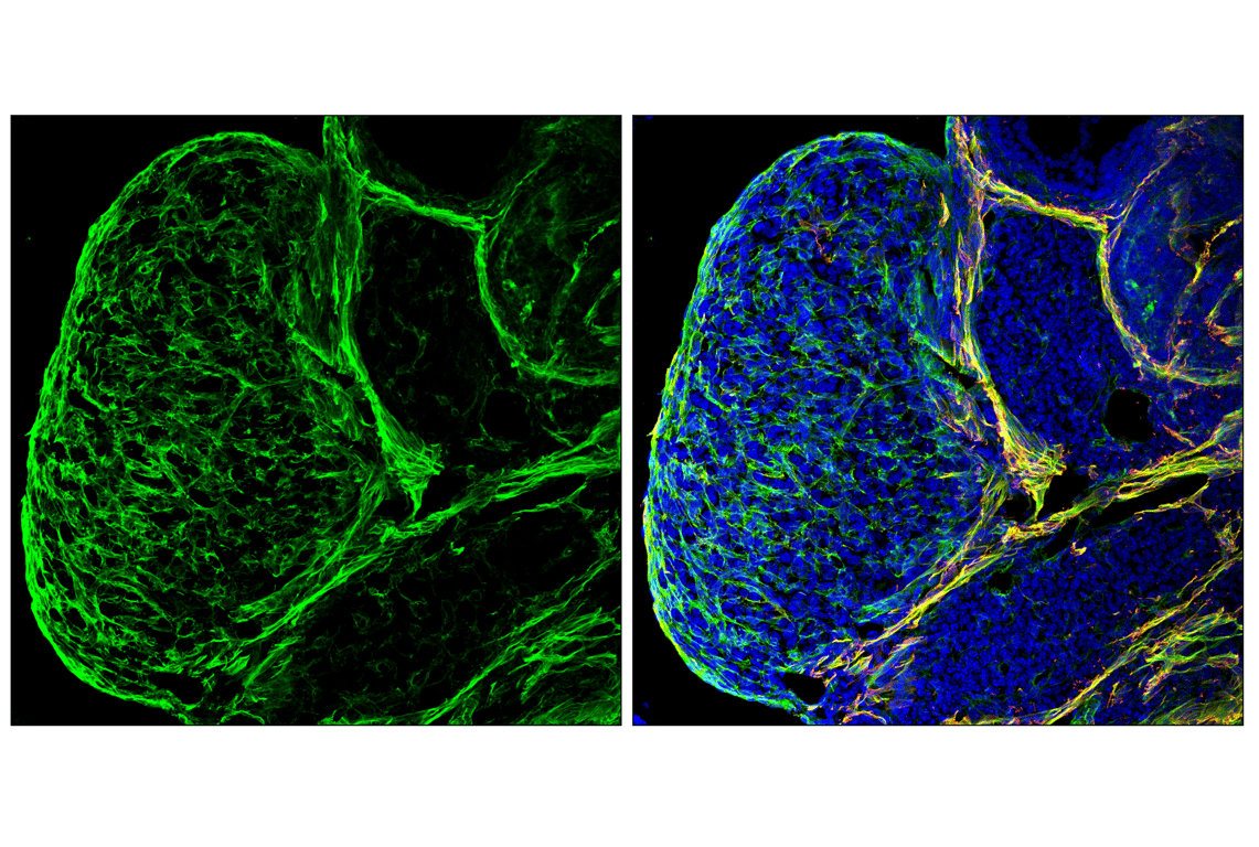 Immunofluorescence Image 1: Caldesmon-1 (D5C8D) Rabbit Monoclonal Antibody