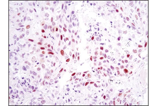 Immunohistochemistry Image 1: Skp2 (D3G5) Rabbit Monoclonal Antibody (BSA and Azide Free)