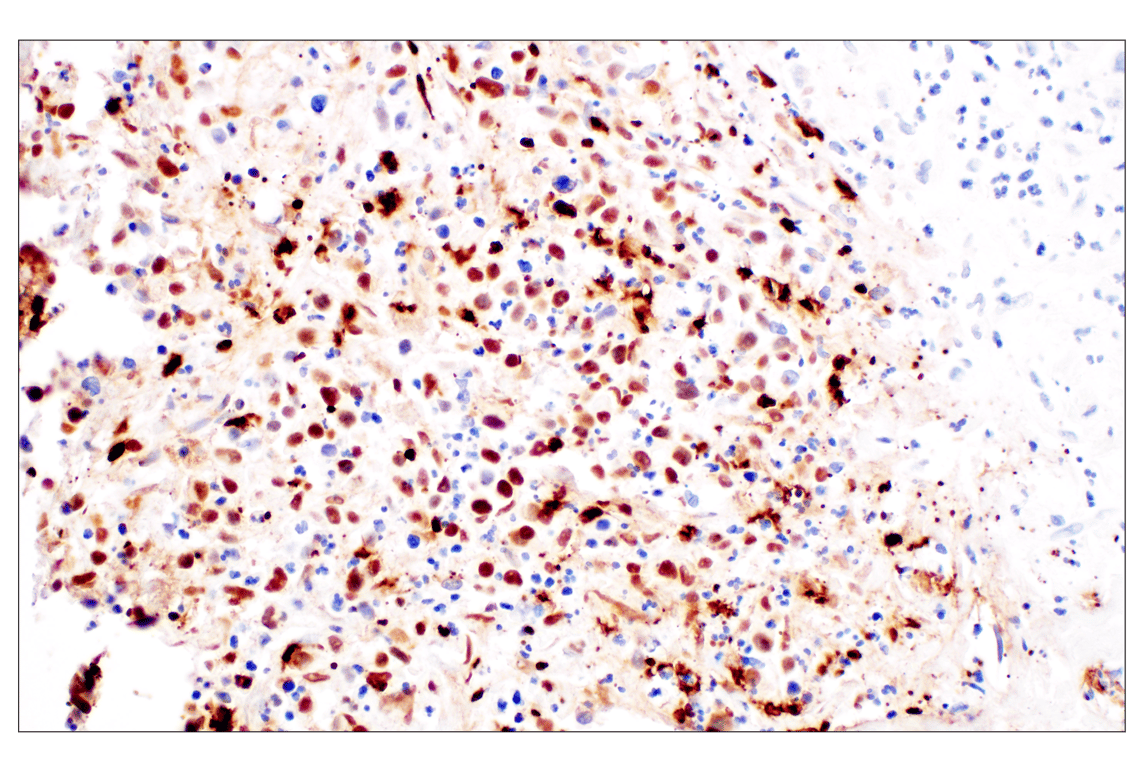 Immunohistochemistry Image 1: Citrullinated Histone H3 (Arg2) (F3C9B) Rabbit Monoclonal Antibody (BSA and Azide Free)