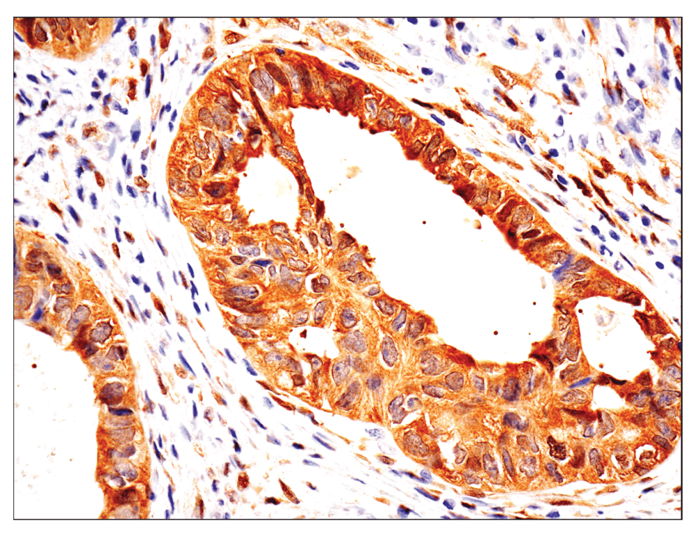 Immunohistochemistry Image 2: YAP (D8H1X) XP<sup>®</sup> Rabbit mAb