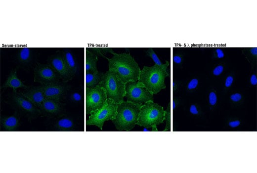 Immunofluorescence Image 1: Phospho-MARCKS (Ser167/170) (D13E4) Rabbit Monoclonal Antibody