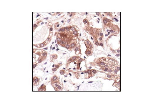 Immunohistochemistry Image 3: MEK1/2 (L38C12) Mouse Monoclonal Antibody (BSA and Azide Free)